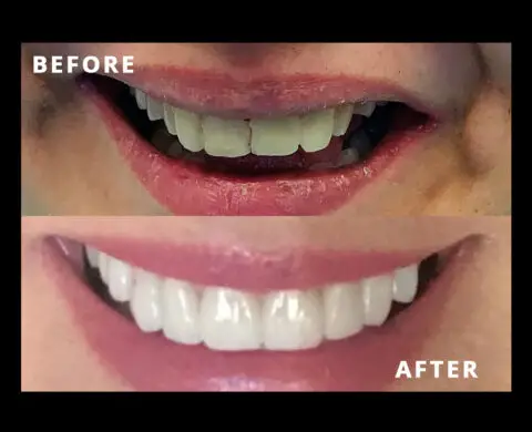 caspian dental center