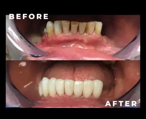 caspian dental center