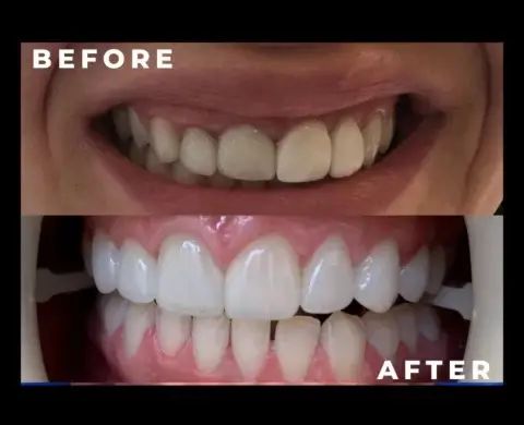 caspian dental center