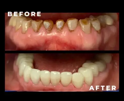 caspian dental center