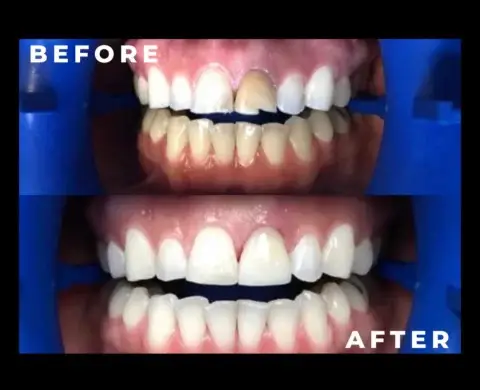 caspian dental center