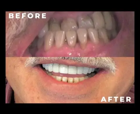 caspian dental center