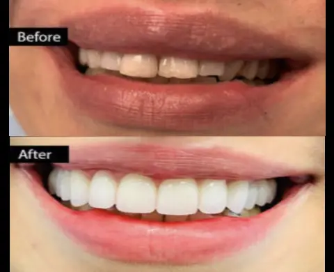 caspian dental center, befafte33