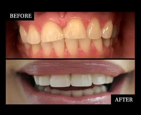 caspian dental center, befafte35