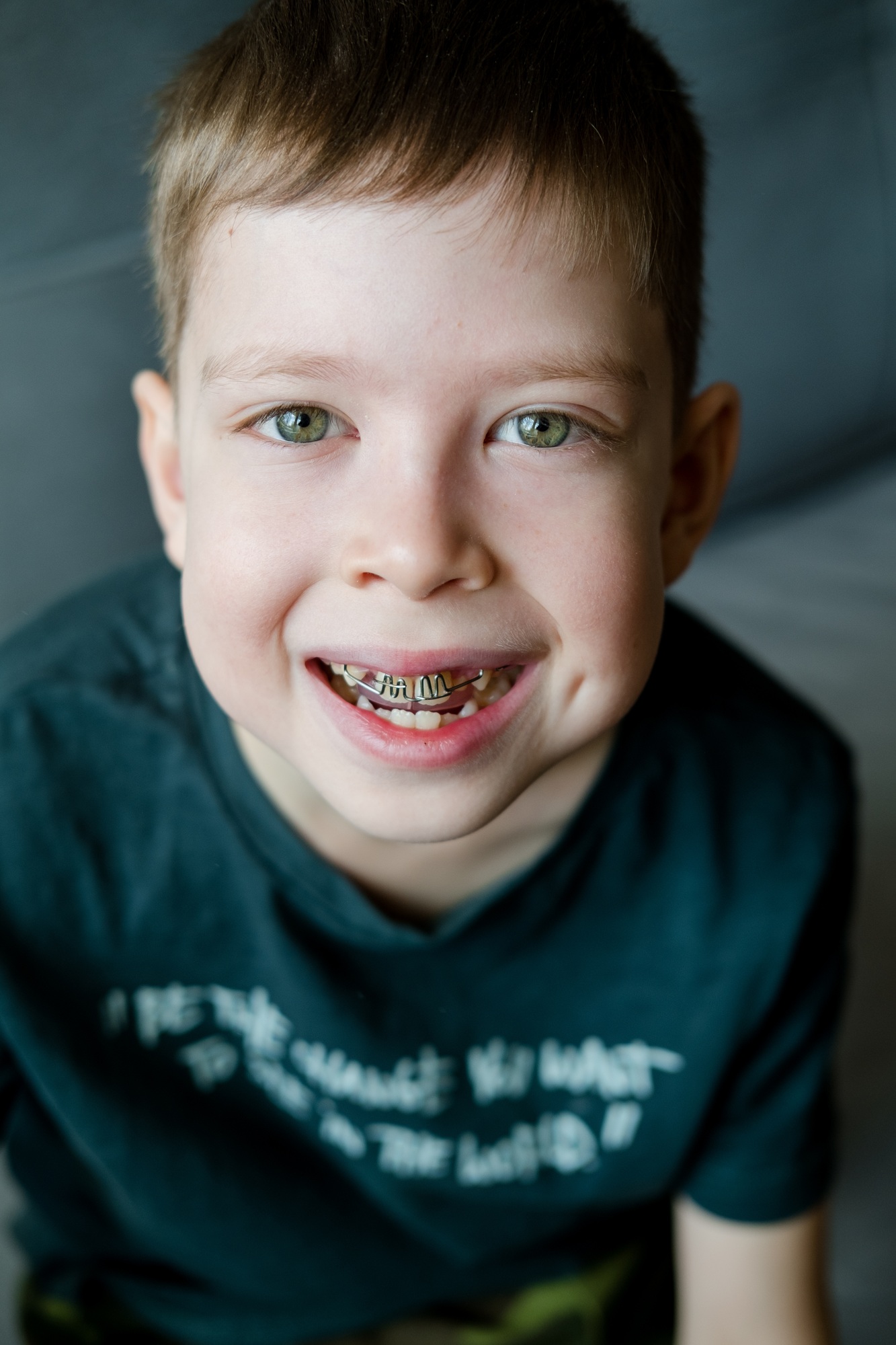 close-up portrait of a boy in braces. Correction of bite in children. The boy wears a dental plate.