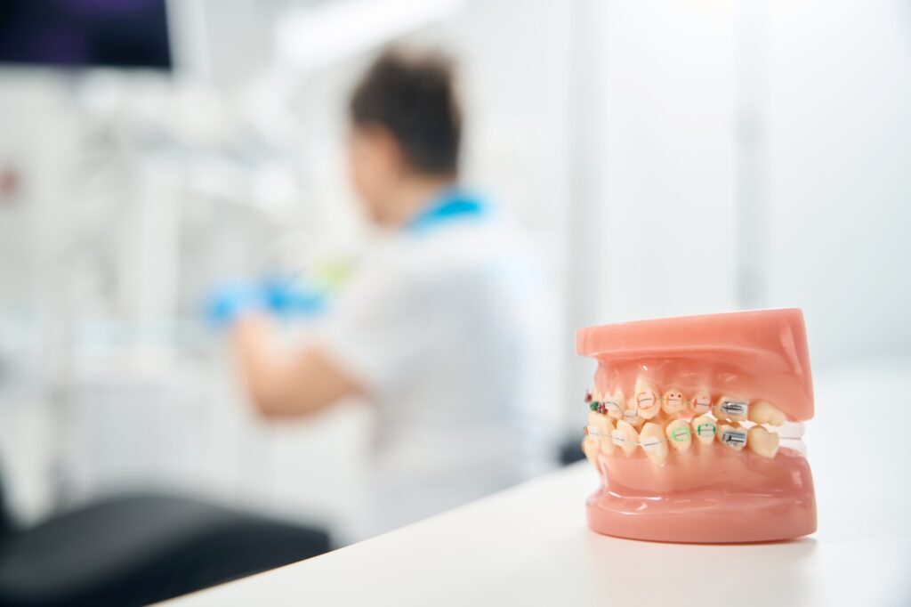 3d model of child jaw with braces