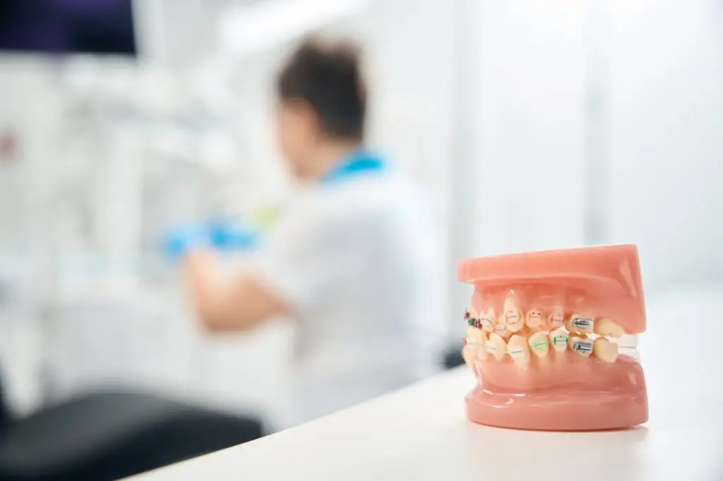 3d model of child jaw with braces